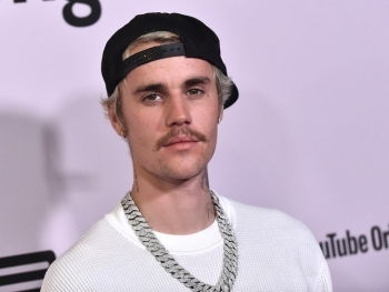 Căn bệnh hiếm gặp khiến Justin Bieber liệt nửa mặt nguy hiểm như thế nào?