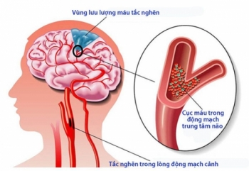 Sức khỏe não bộ