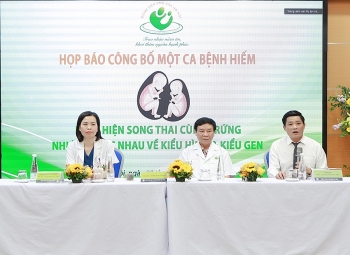 Bệnh viện Phụ sản Hà Nội ghi nhận ca song thai cực hiếm xuất hiện lần đầu tiên tại Việt Nam