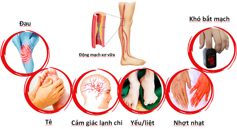 Vấn đề  của hệ tim mạch